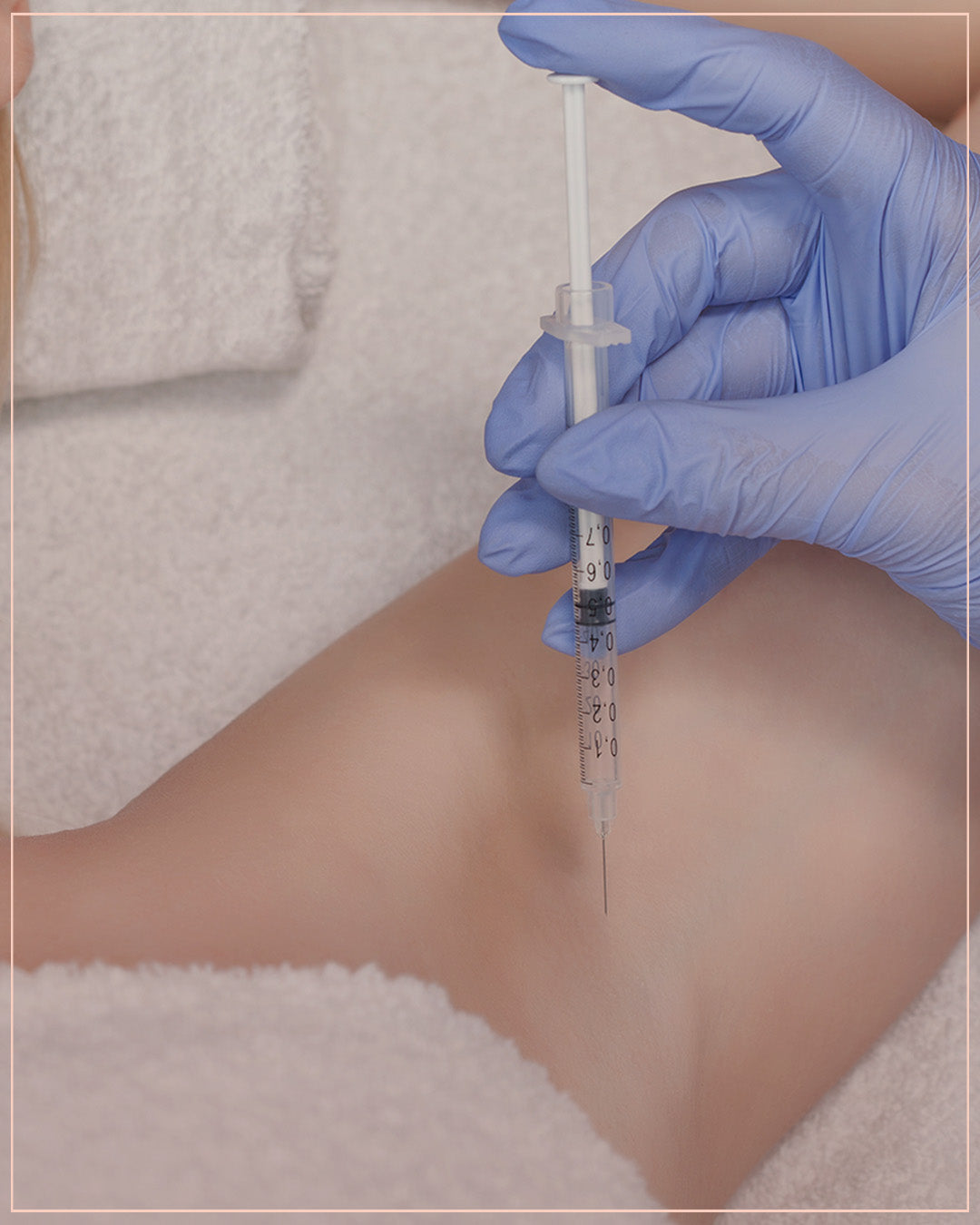 Botox for Excessive Sweating Treatment