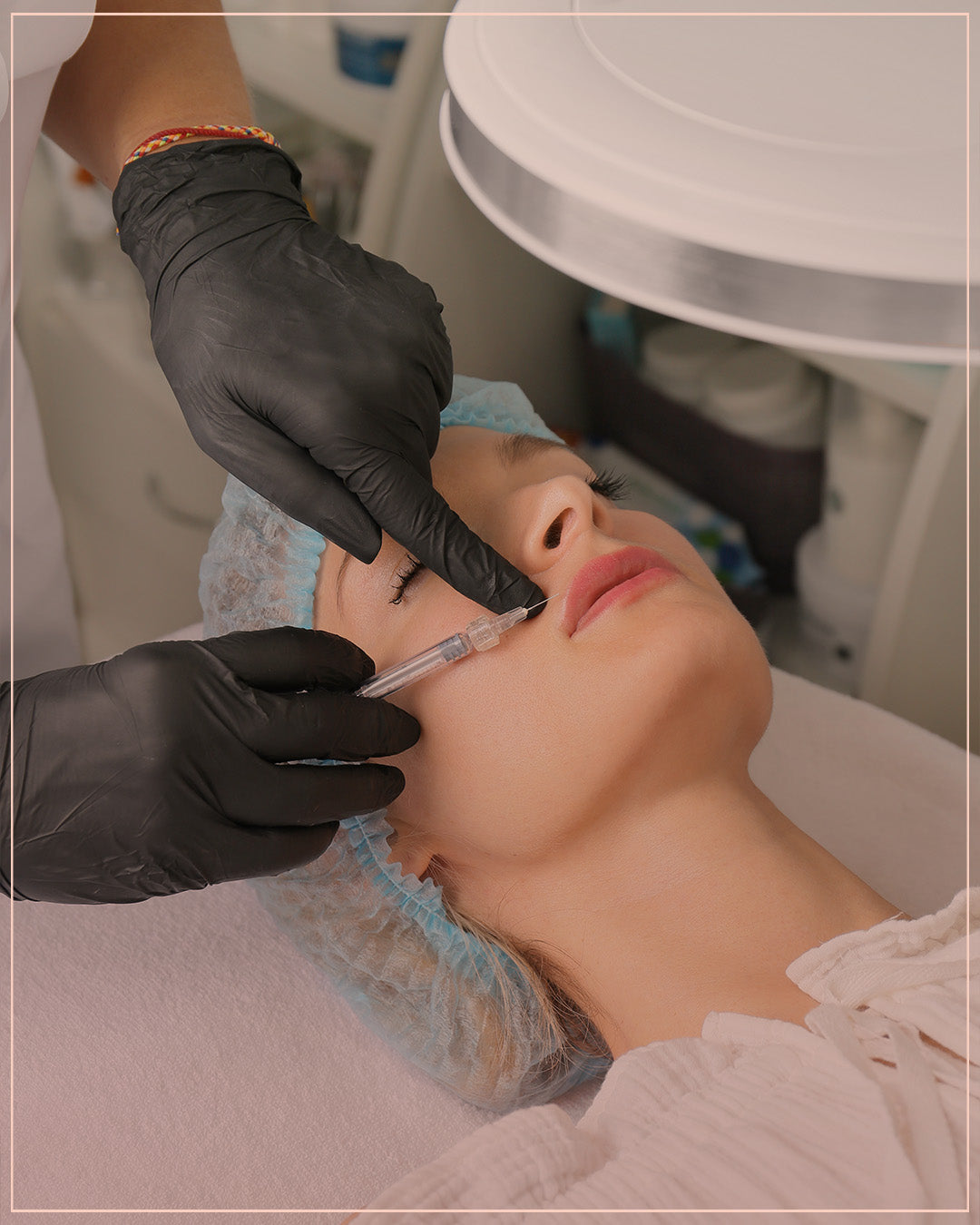 Botox for Gummy Smile Treatment