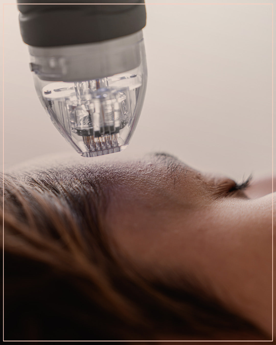 Two Sylfirm Sessions with Two stem cells injections and Hydrafacial session for free