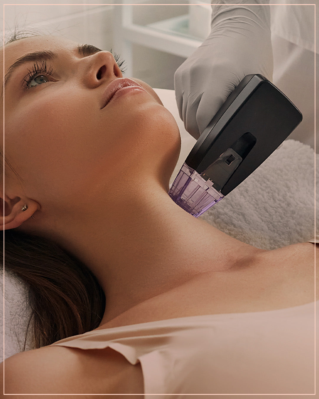 Morpheus session for The Belly stretch marks treatment