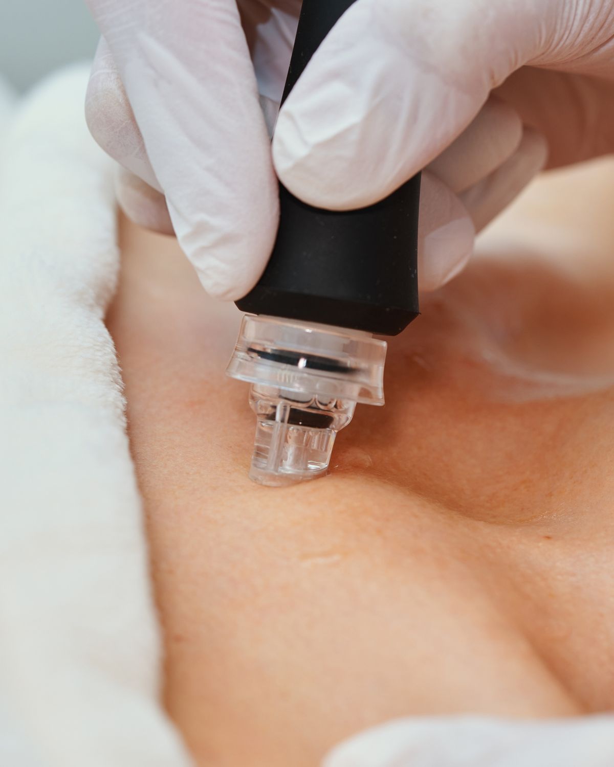 تنظيف بشرة للاندرارم مع ماسك