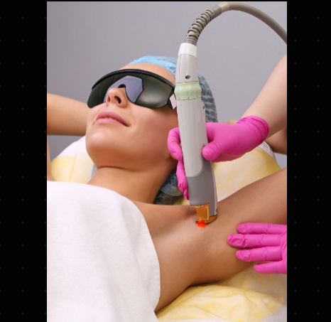 جلسة ليزر لمنطقتين صغيرة (وجه و أبطين) للنساء أو الرجال بدون رتوش