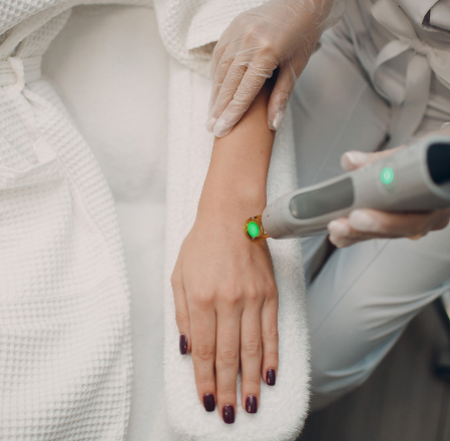 جلسة ليزر منطقة صغيرة (بكيني نساء) بدون رتوش