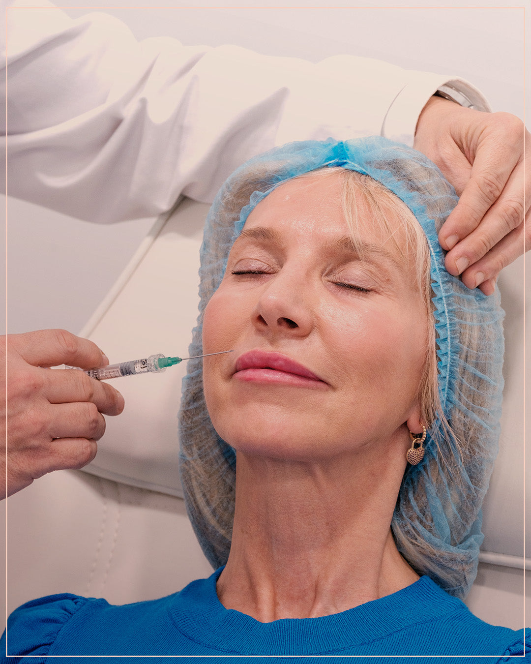 SMAS Botox for Face Lifting