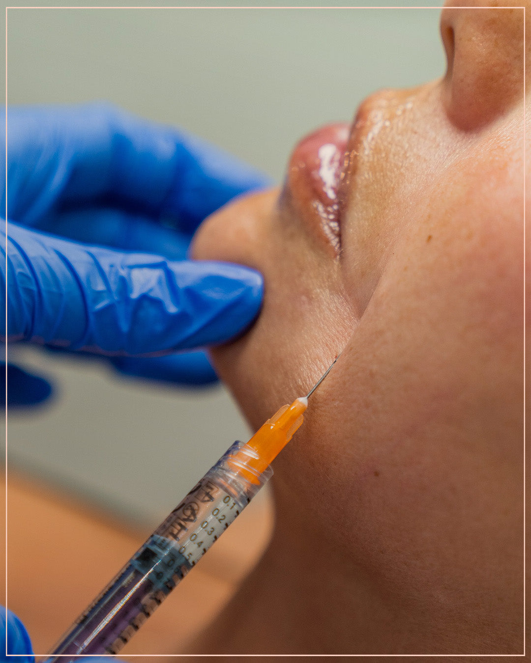 Filler package Buy 3ML get 1ML Free