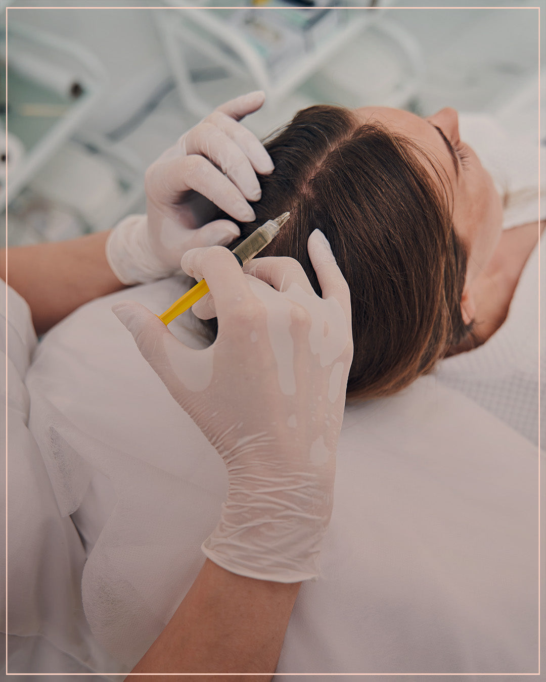 PRP with Stem Cells for Hair Loss