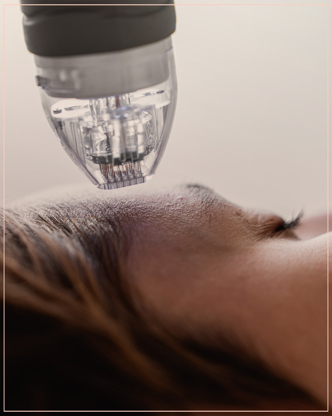 Two Virtue sessions with stem cells