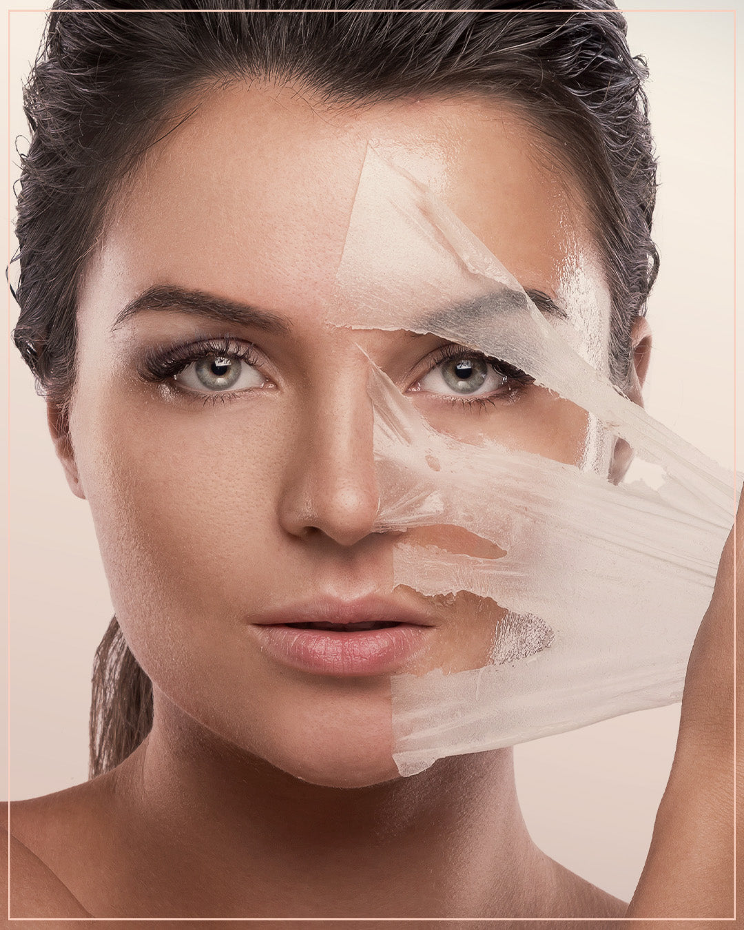 Cold peeling with cream (Amelan)