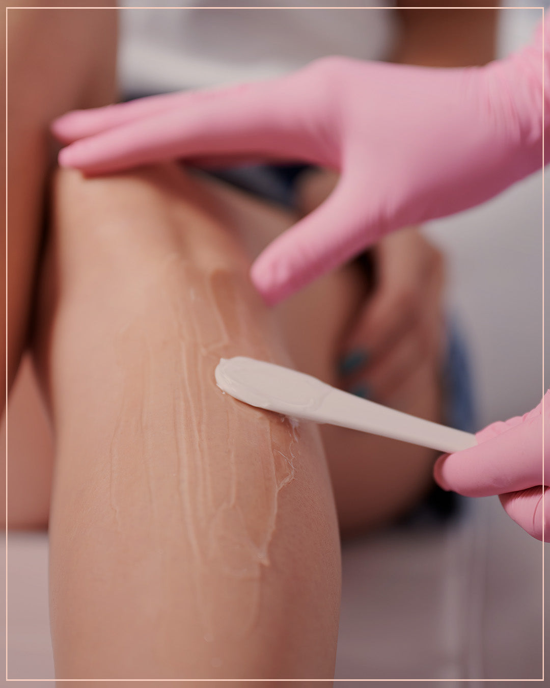 Chemical peeling For Knees and  Elbows