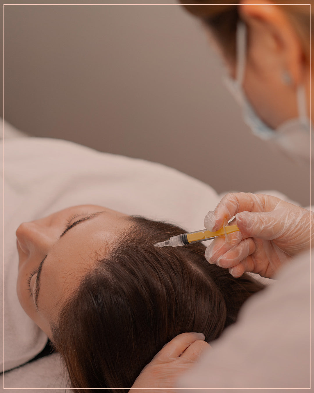 Plasma with Exosome session for Hair loss treatment