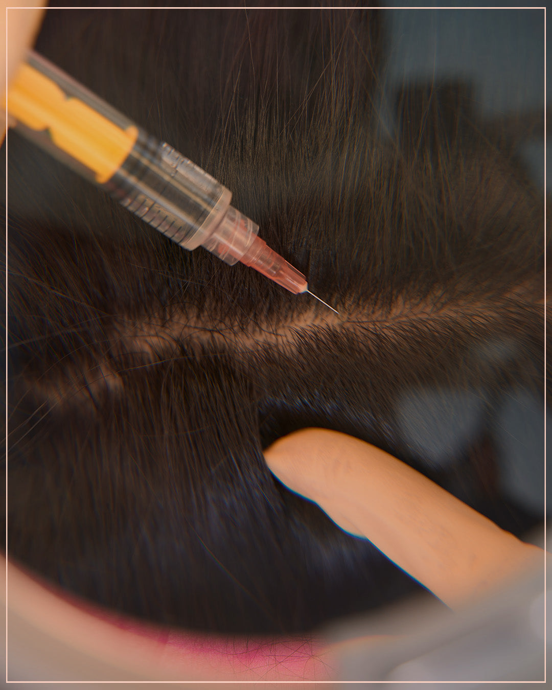 Plasma hair treatment