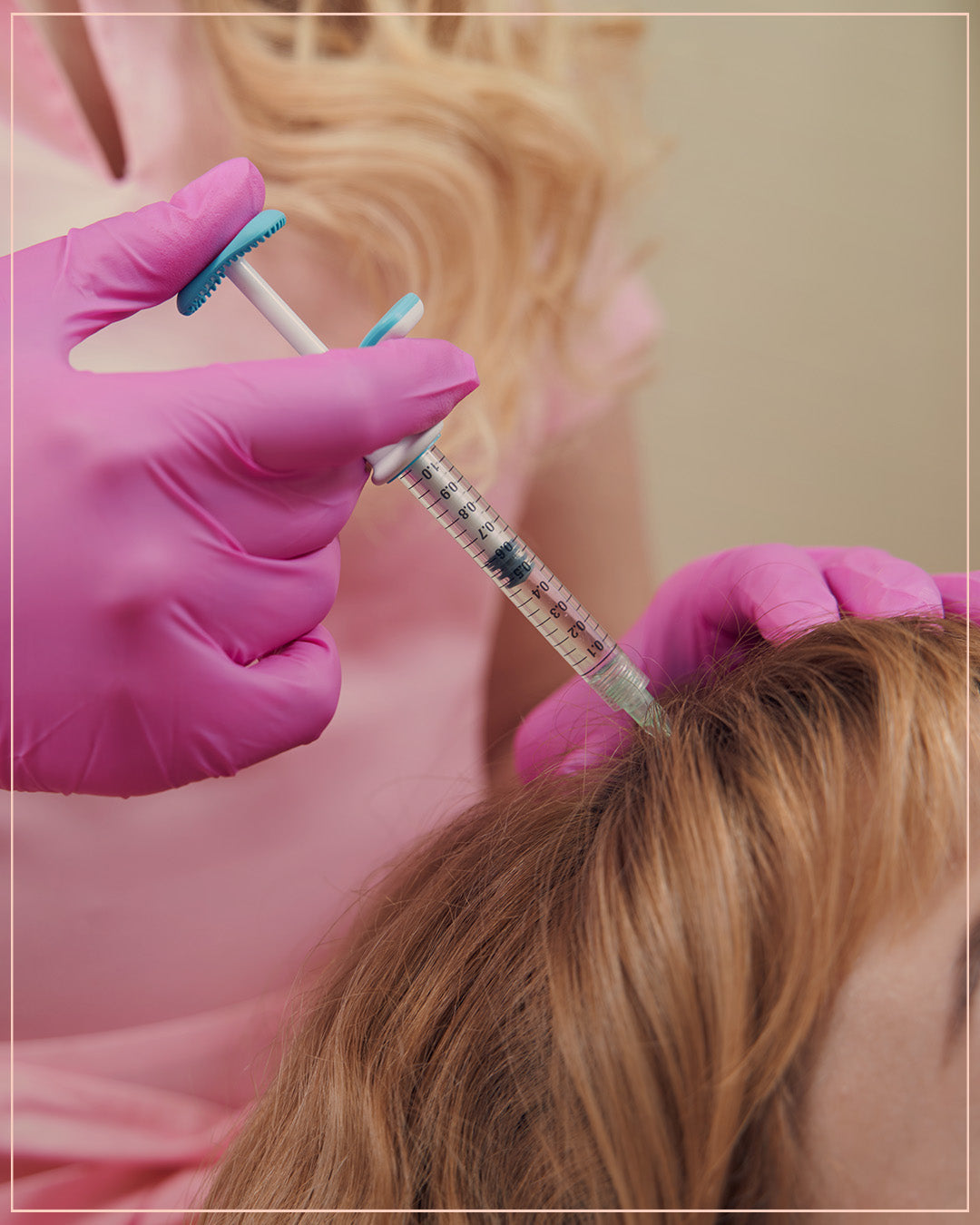 Exosomes hair treatment