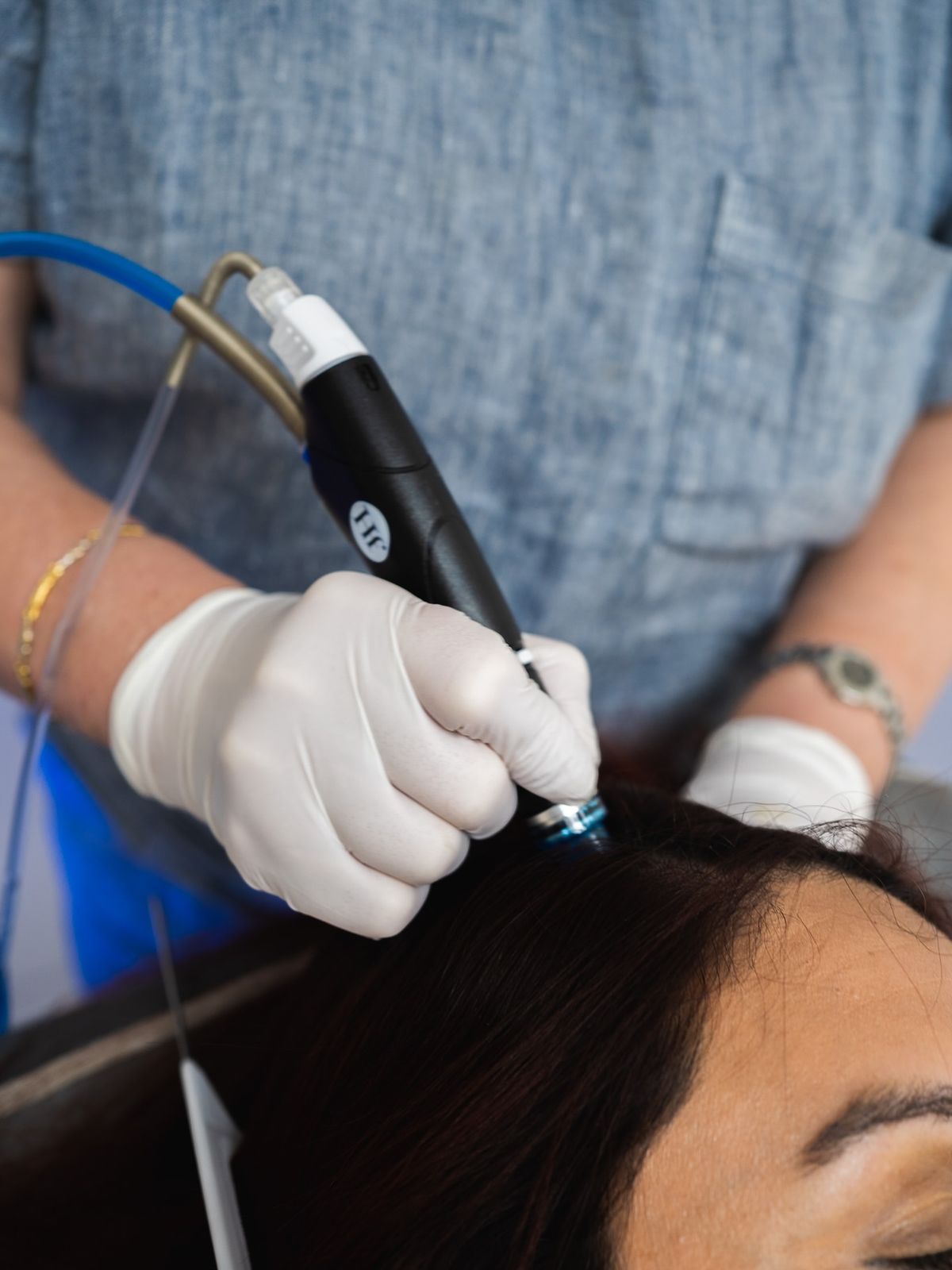 تنظيف بشرة فروة الرأس