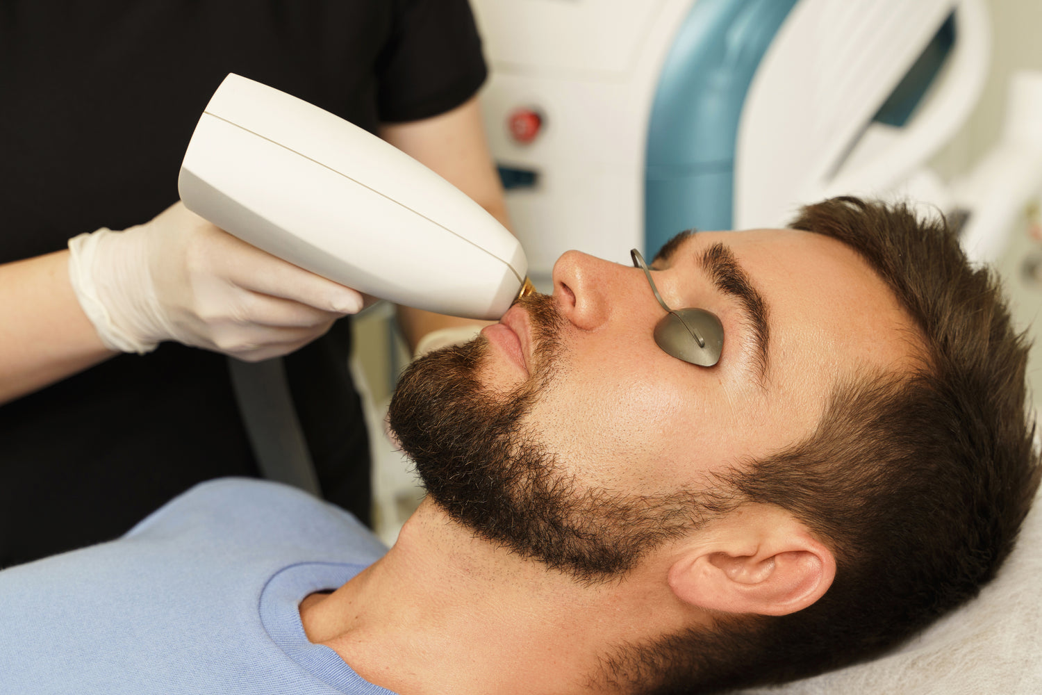 ثلاث جلسات ليزر ازالة الشعر كامل الجسم للرجال مع الرتوش