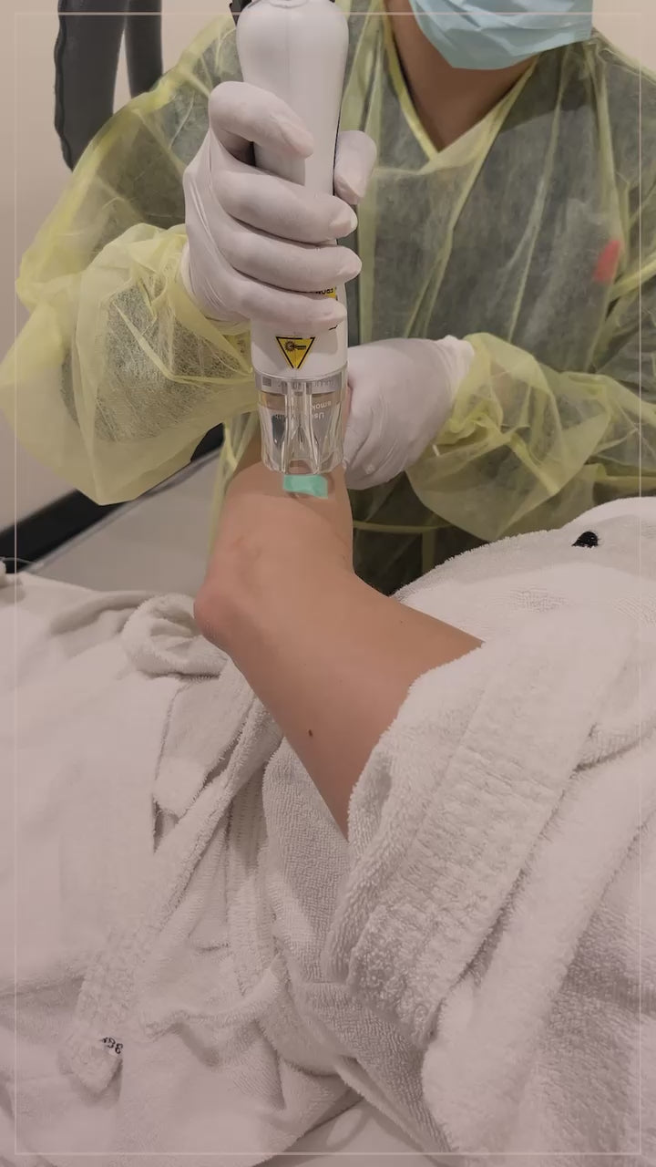 full boy hair removal