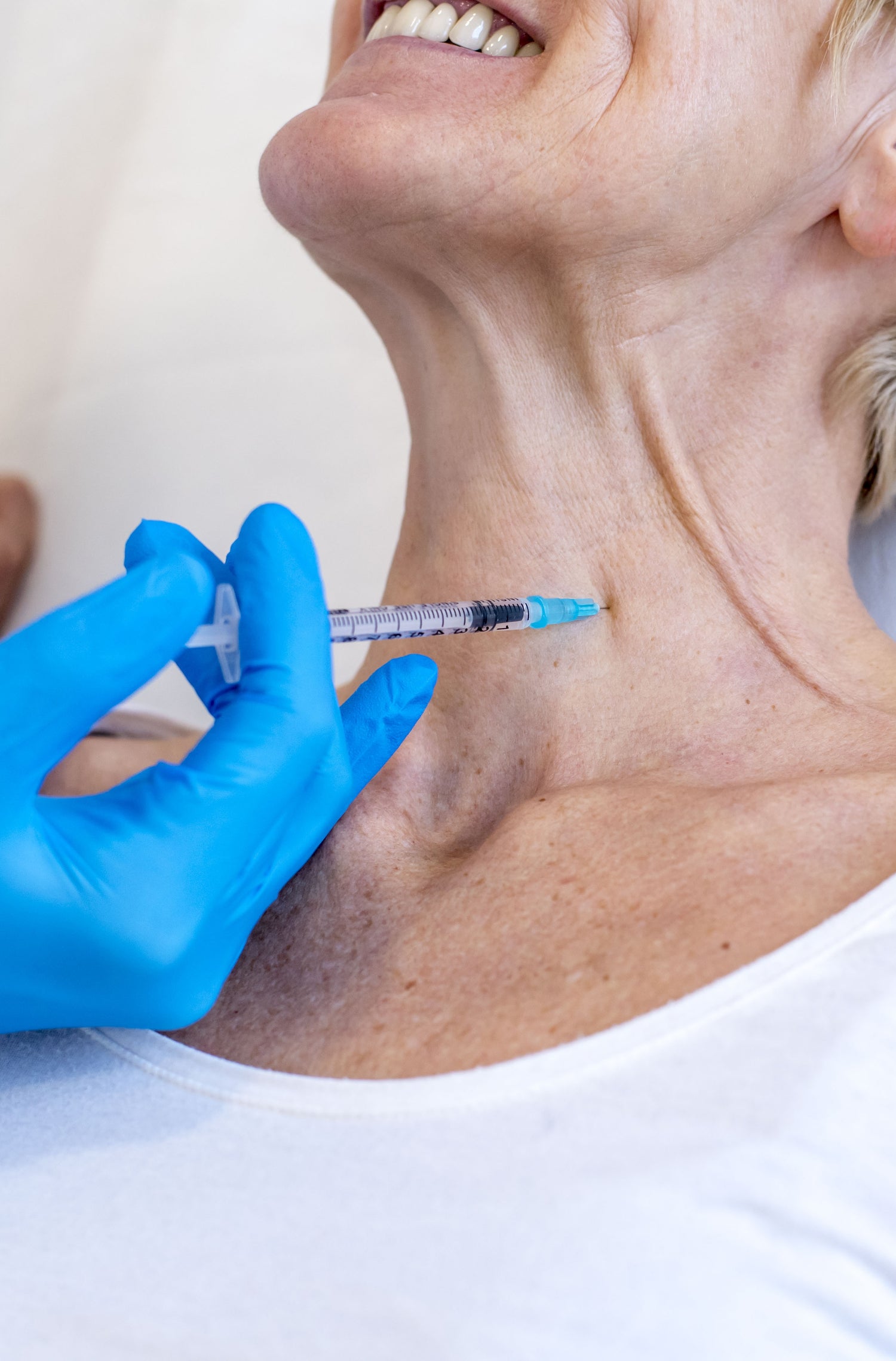 Radiesse Injections for Neck Lines