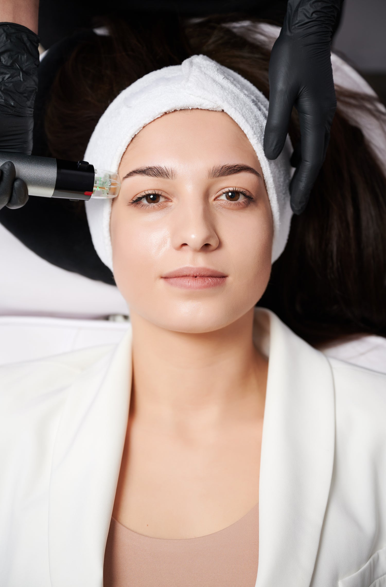 Sylfirm Sessions with Stem Cells for Pigmentation Treatment